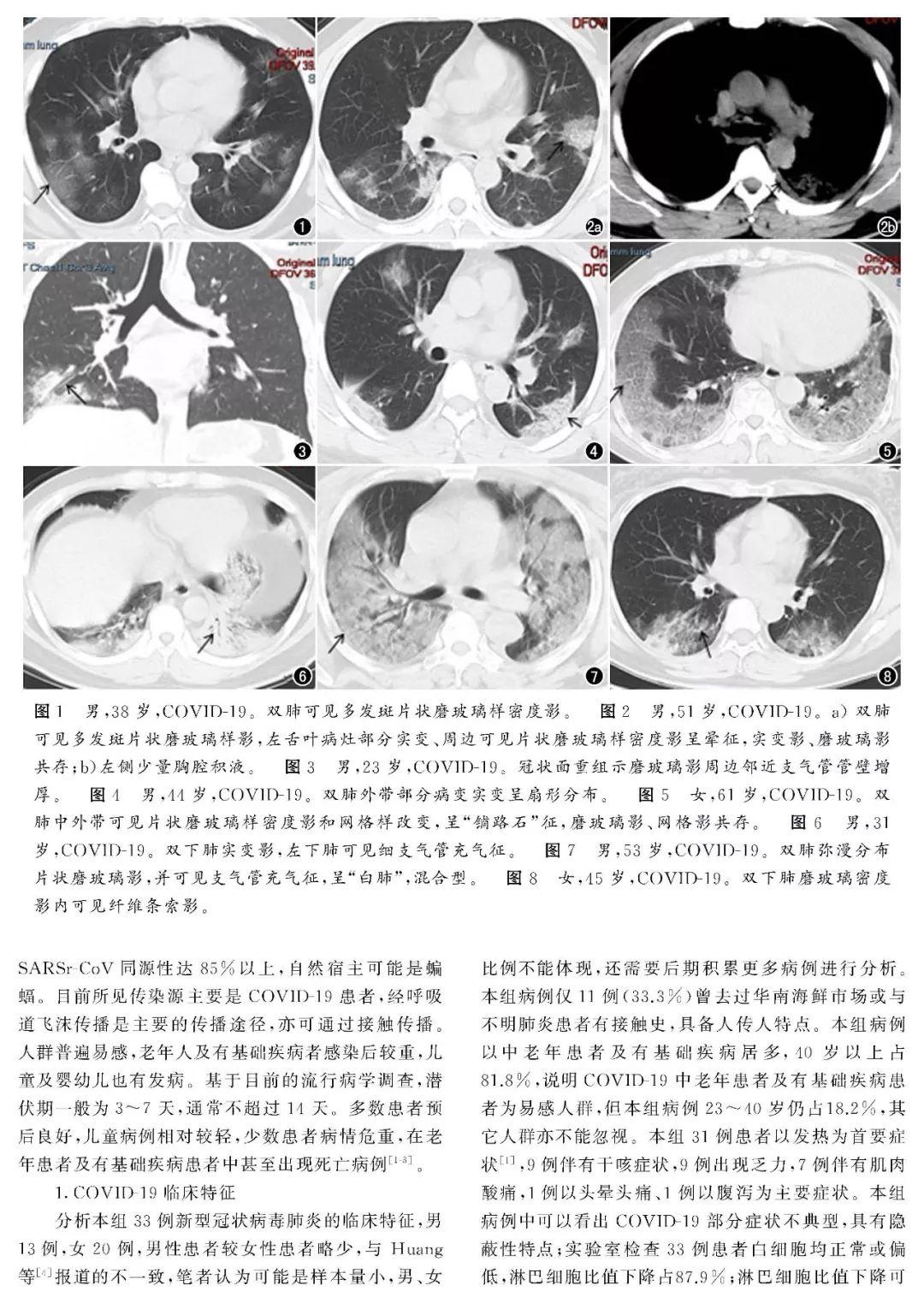 全球視野下的新貴肺炎最新動態與應對策略